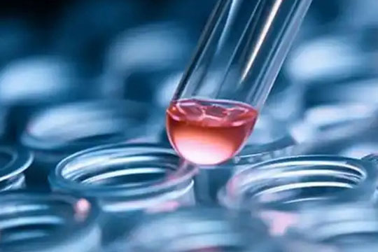 BNCC Ebola (Bendibur type) pseudovirus quality control products to aid in accurate nucleic acid testing